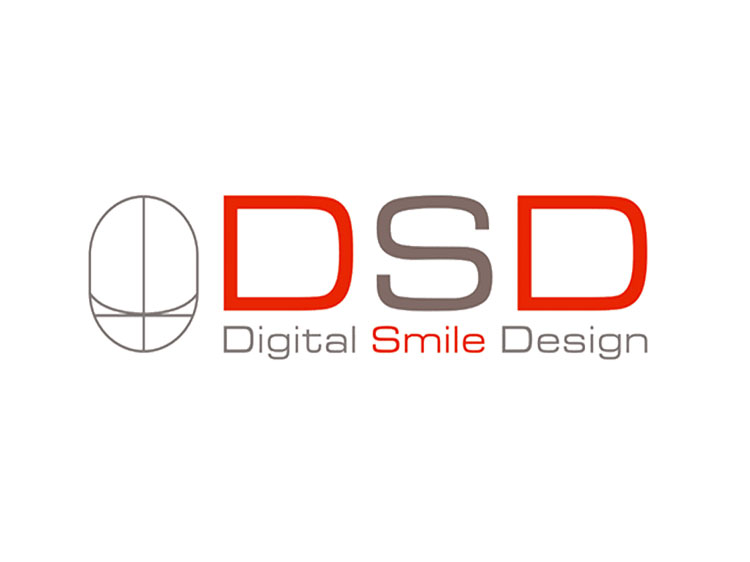 DSD