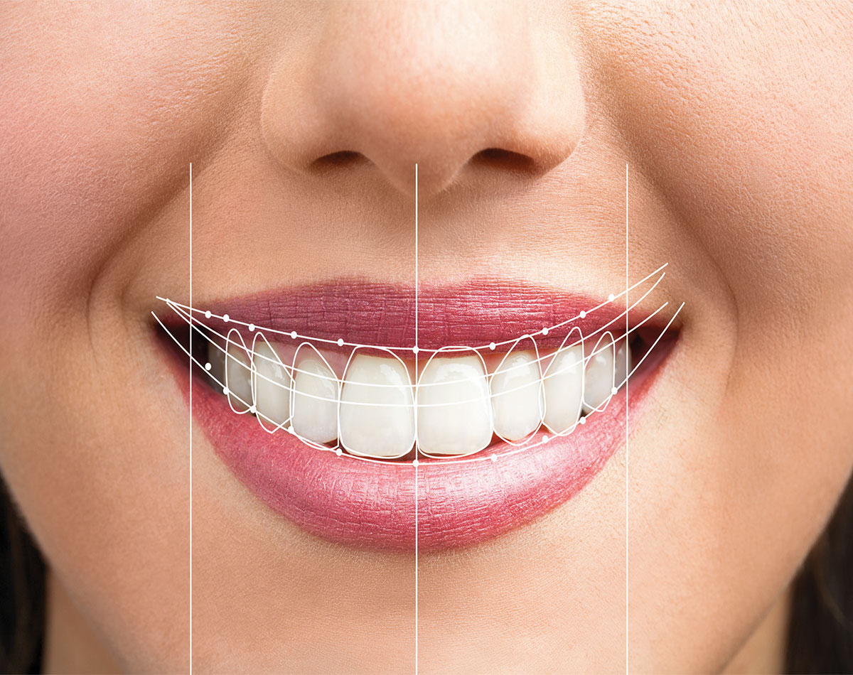 Digital-Smile-Designing