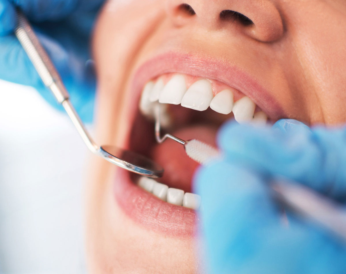 Root-Canal-Treatment