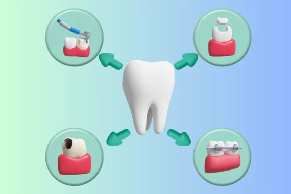 Types-of-Full-Mouth-Rehabilitation