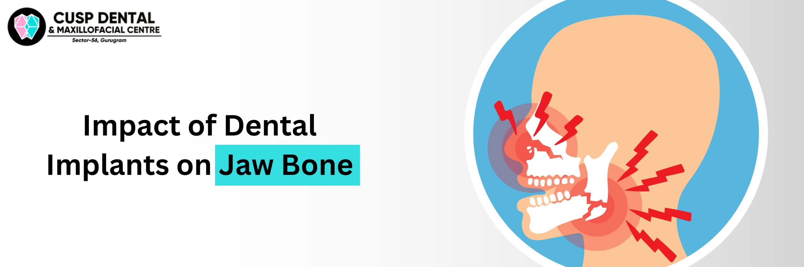 impact-of-dental-implants